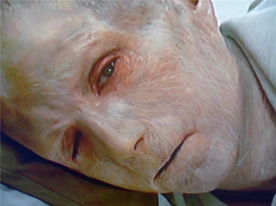 635889605255760168.png?type=w3