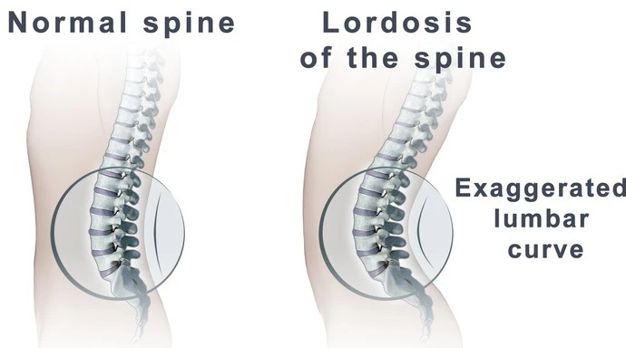 990A86485AA092E026B4F3