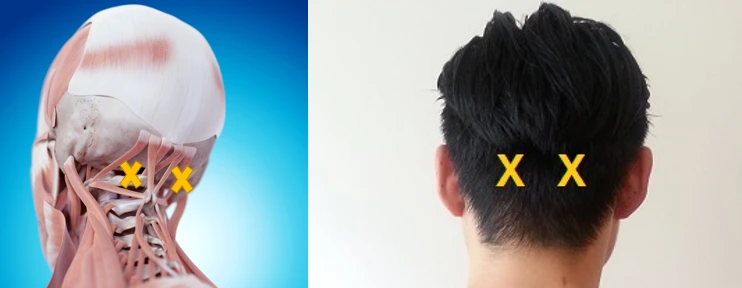 99A2E8455A94D18828CD64