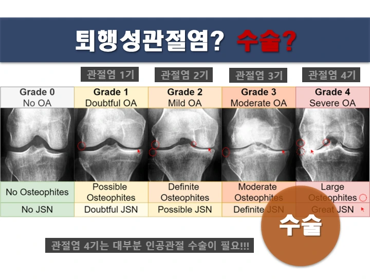 SE-23db237e-4ac5-421e-88ff-0a3bc8fc01ce.png?type=w966