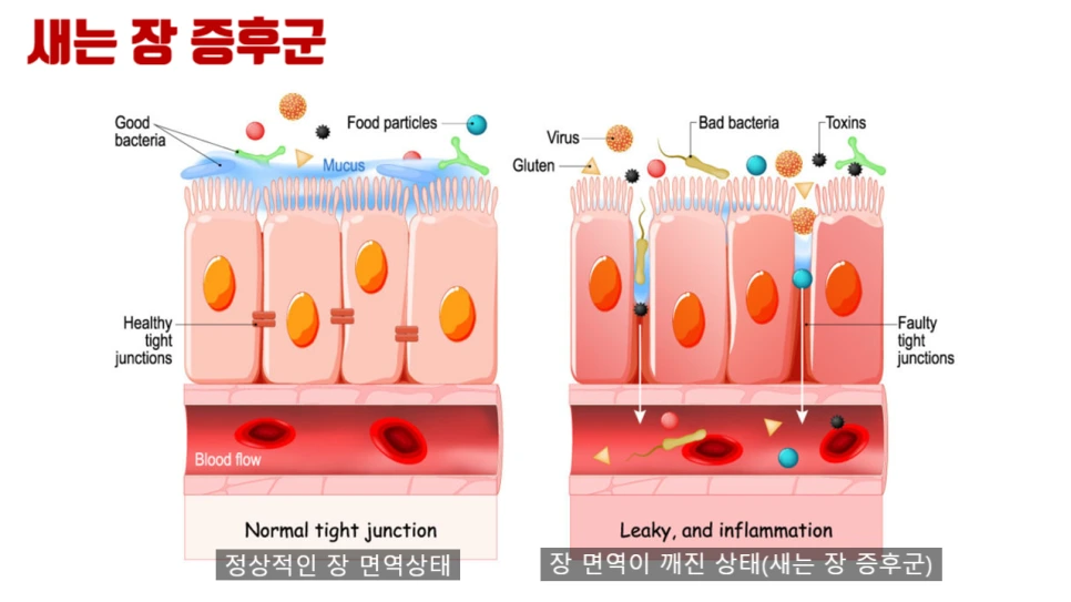 SE-a4b45b2d-514c-4088-aab9-95bdb7cc8e51.png?type=w966