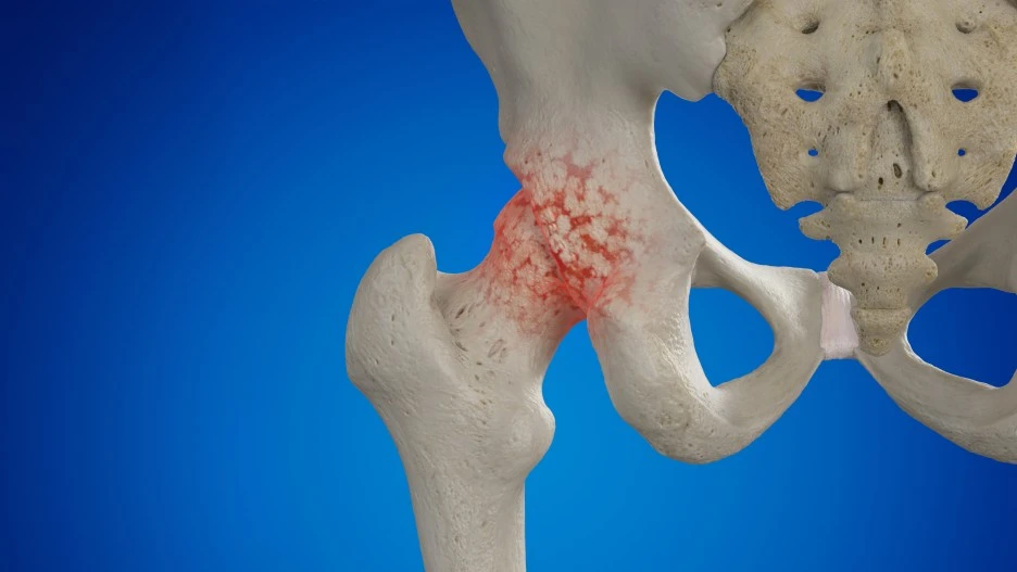 CK_pc0040589344.jpg?type=w1