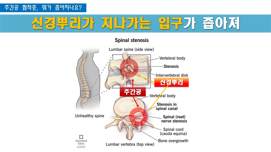 %EC%8A%AC%EB%9D%BC%EC%9D%B4%EB%93%9C7.PNG?type=w1