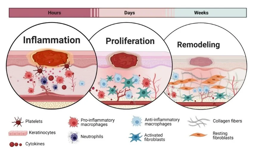 Wound-healing-phases-The-timeline-and-overview-for-the-healing-phases-also-s.jpg?type=w1