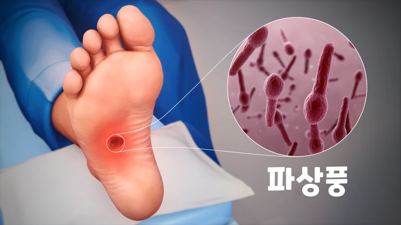 %ED%8C%8C%EC%83%81%ED%92%8D-1.png?type=w966