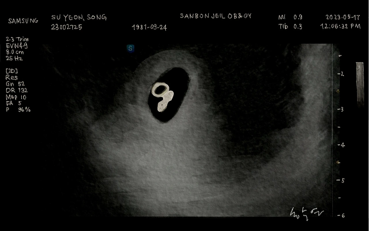 초음파사진.jpeg