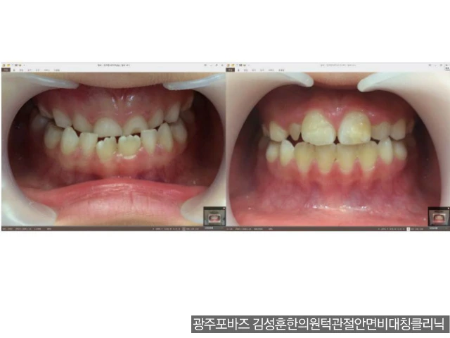 23150E4B56CFAAC91F95ED