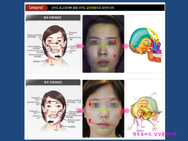 23724036567A1355212B44