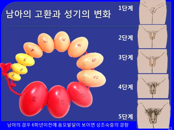 24263A3556C44C813CD5EC