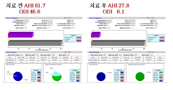 27539E4D570361871601F2