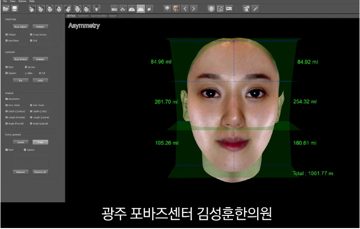 25596D3A56FA520F25DBFE