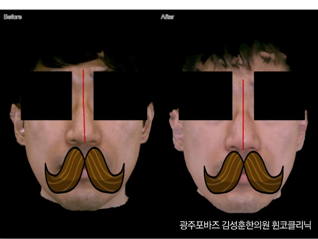 2331FB4E571744AF17C315