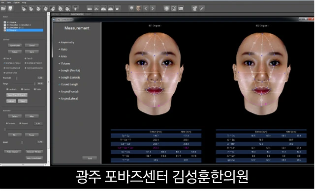 241AC93A56FA520C03A5CB