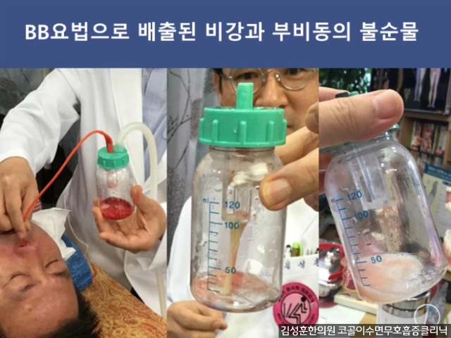 26457A435781B63703DCBC