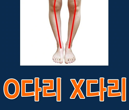 2709584556B154CD294721