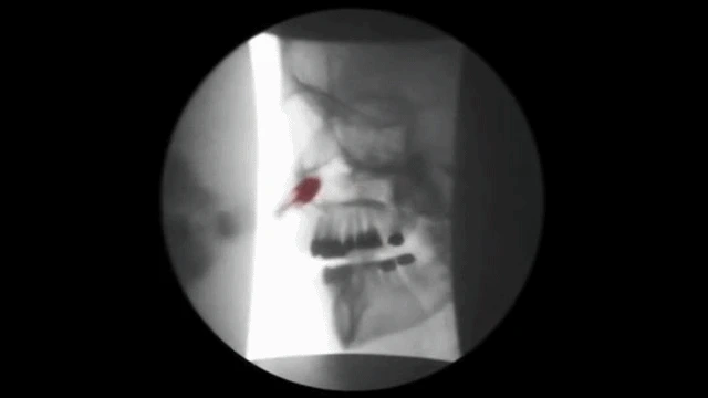 23170B4D56767656226B06