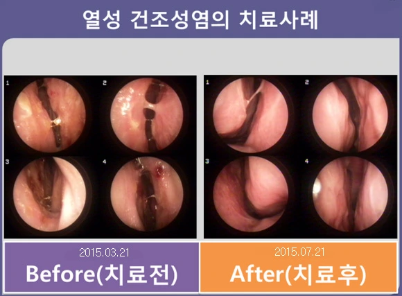 22256D4556FD9CB8352DF6