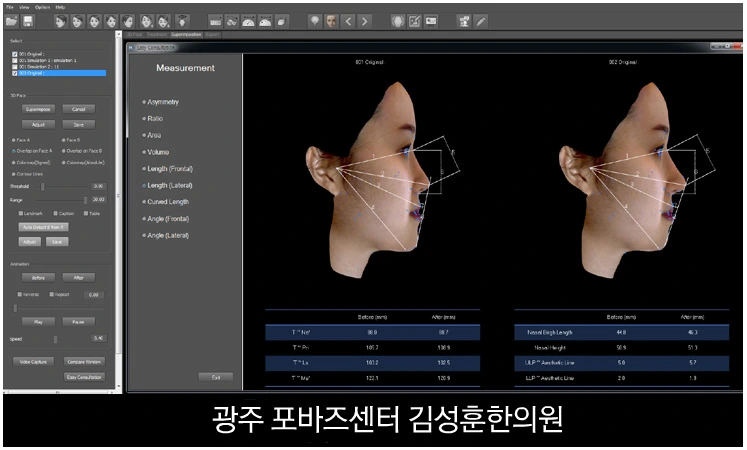 217E113A56FA520D10B9AA