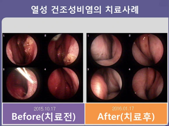 225C123856FD9D35175E69