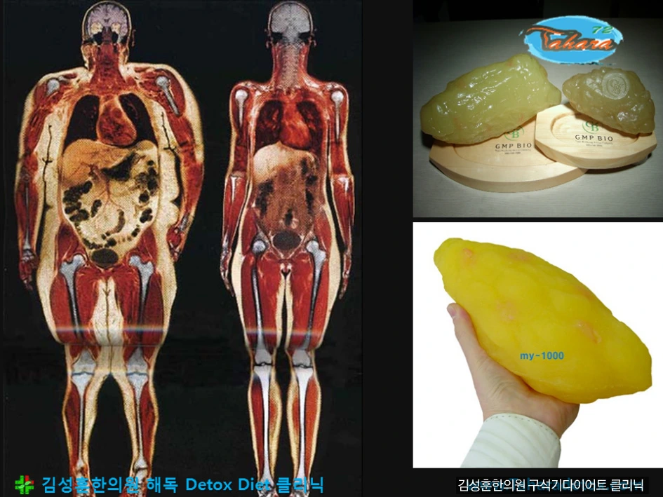 230C423B5695CA5D23F12C