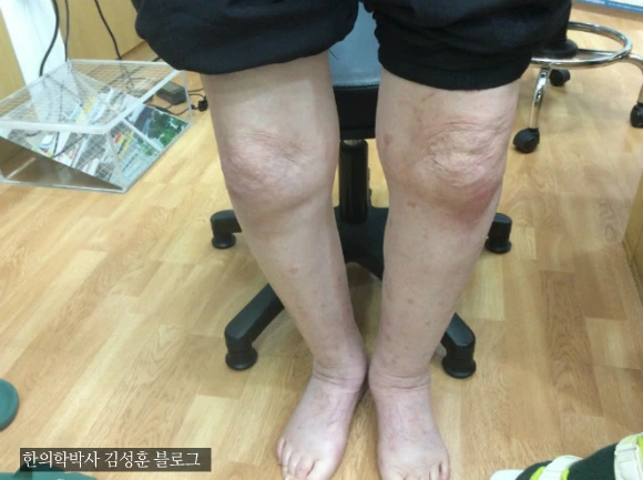 24321436568BA29F3168C9