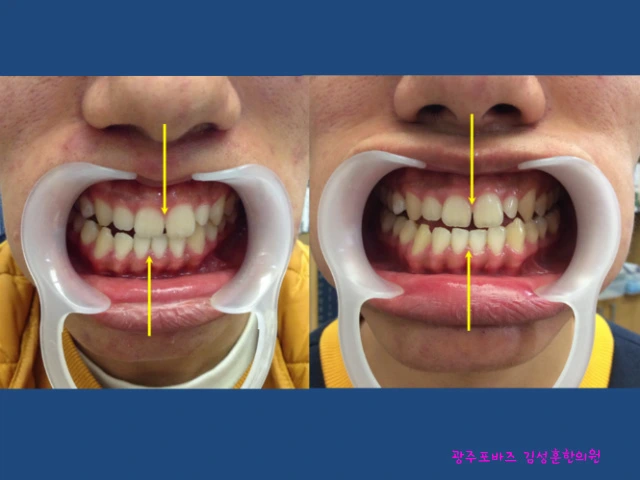 212EE83E567A1B501D92A8