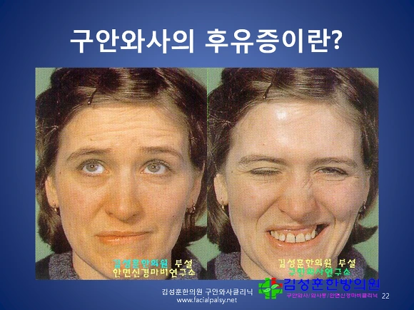 211C0B3656CC248A17692B