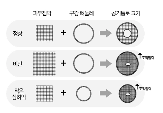 225BAC4156DFDDAF0391E1