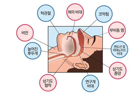 21608E3F5695D5AD20814B