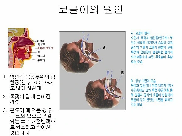 255E003A56682843188423