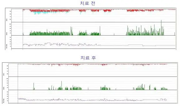 2455EC4B5703615E13619E