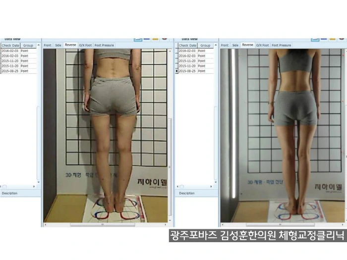 23515239572ADA952E31F4