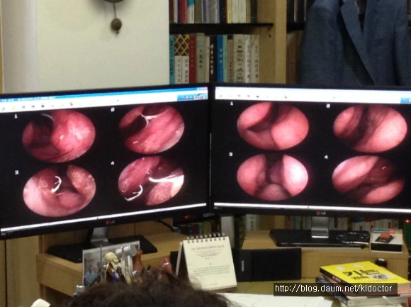 217A333D56C7F975020D5C