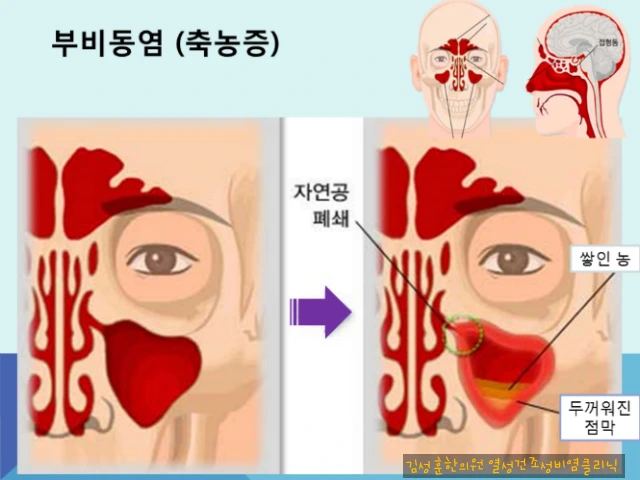 22673345565FE220309000