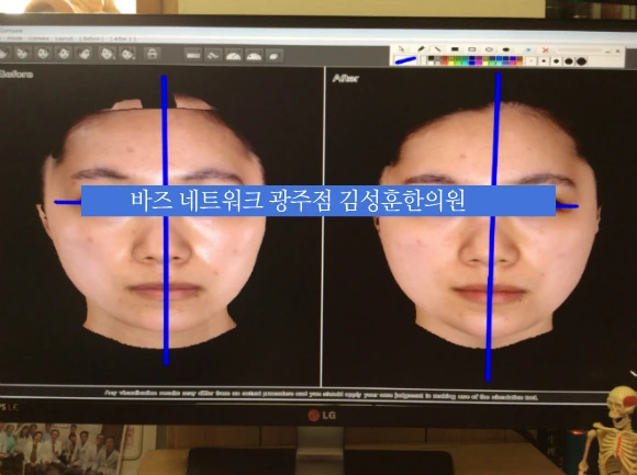 226D5A455676734D345D58