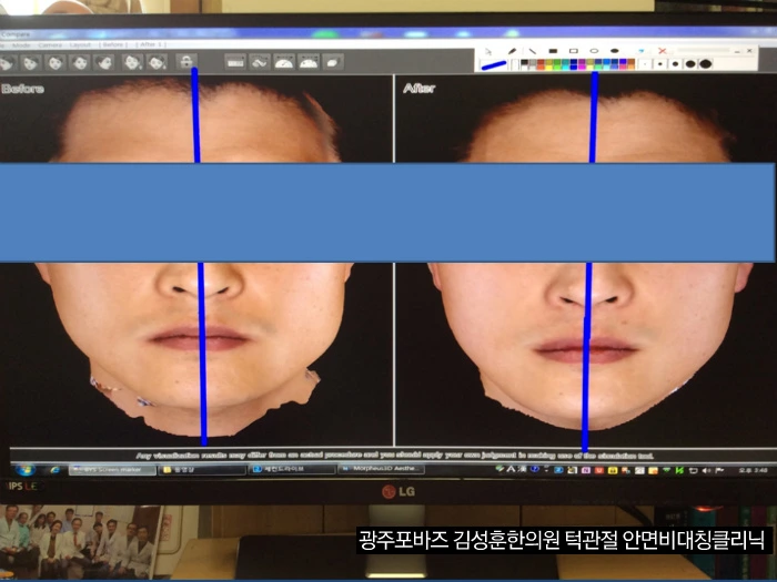 2152723557327F9322A8AD