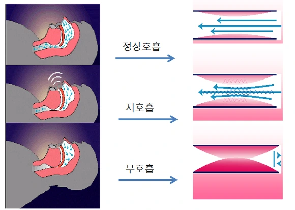2442BD3A56DFE191218E4B
