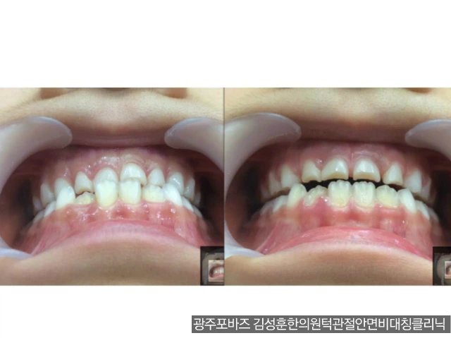 2377614B56CFAAC836B1A5