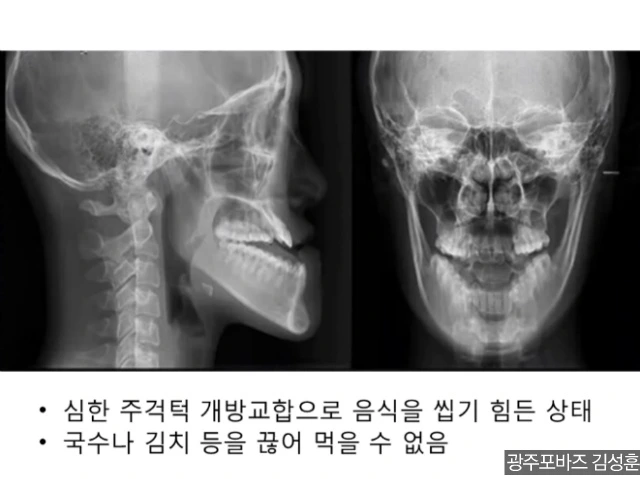 262DA14B56CEEA76229D0A