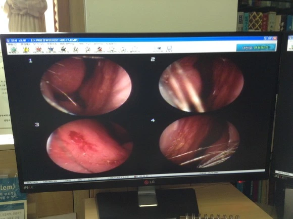 235CA84F56FD99D8321BC6