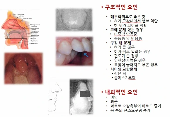 244FDE4C56DFE713143D49