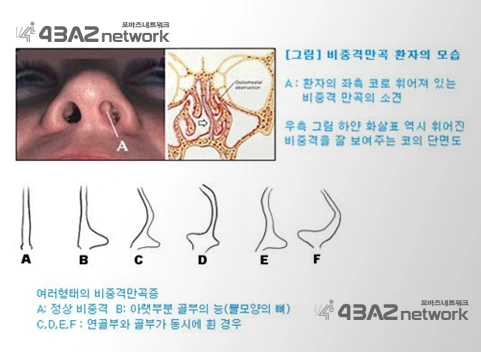 235F2340565812D00CF773