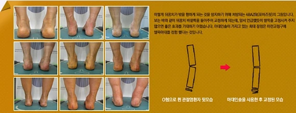 2149A14A5708CE5C0DE8F7