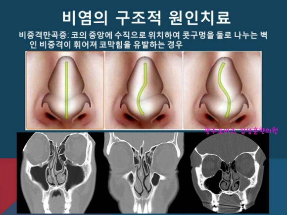 240E70405658F8CC3B2BC5