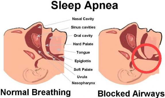 2569A93A5668284112C087