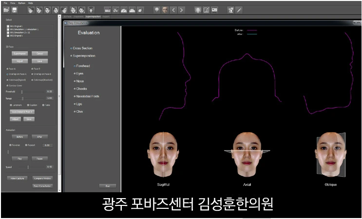 26056B4056FA52132287AD