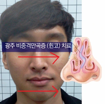 231DDB485717012116DB7D