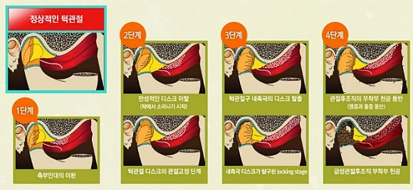 224A4B335655450107F1B5