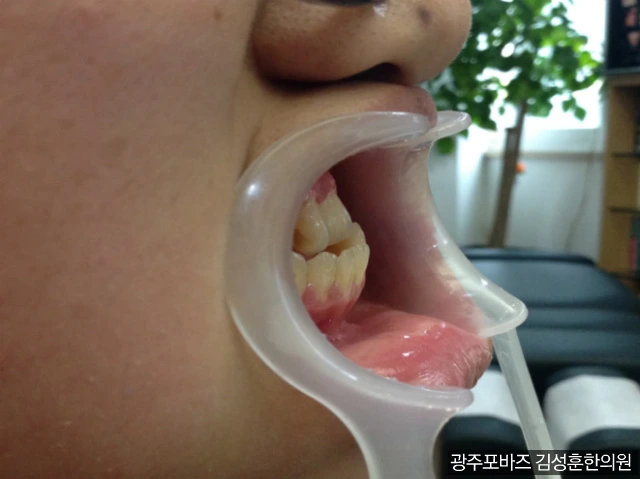 223CD84B56CEEA75145820