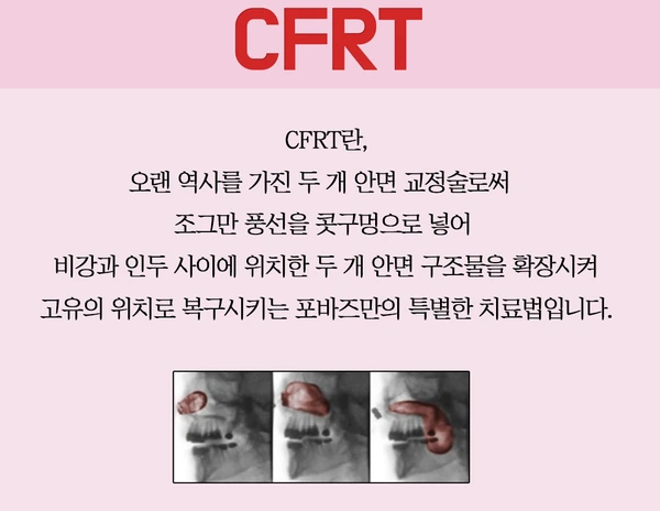 2262955056BBF85C442922